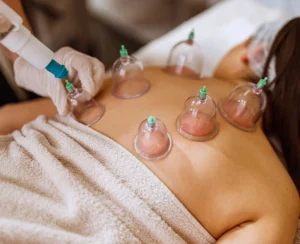 cupping therapy near me
cupping therapy at home